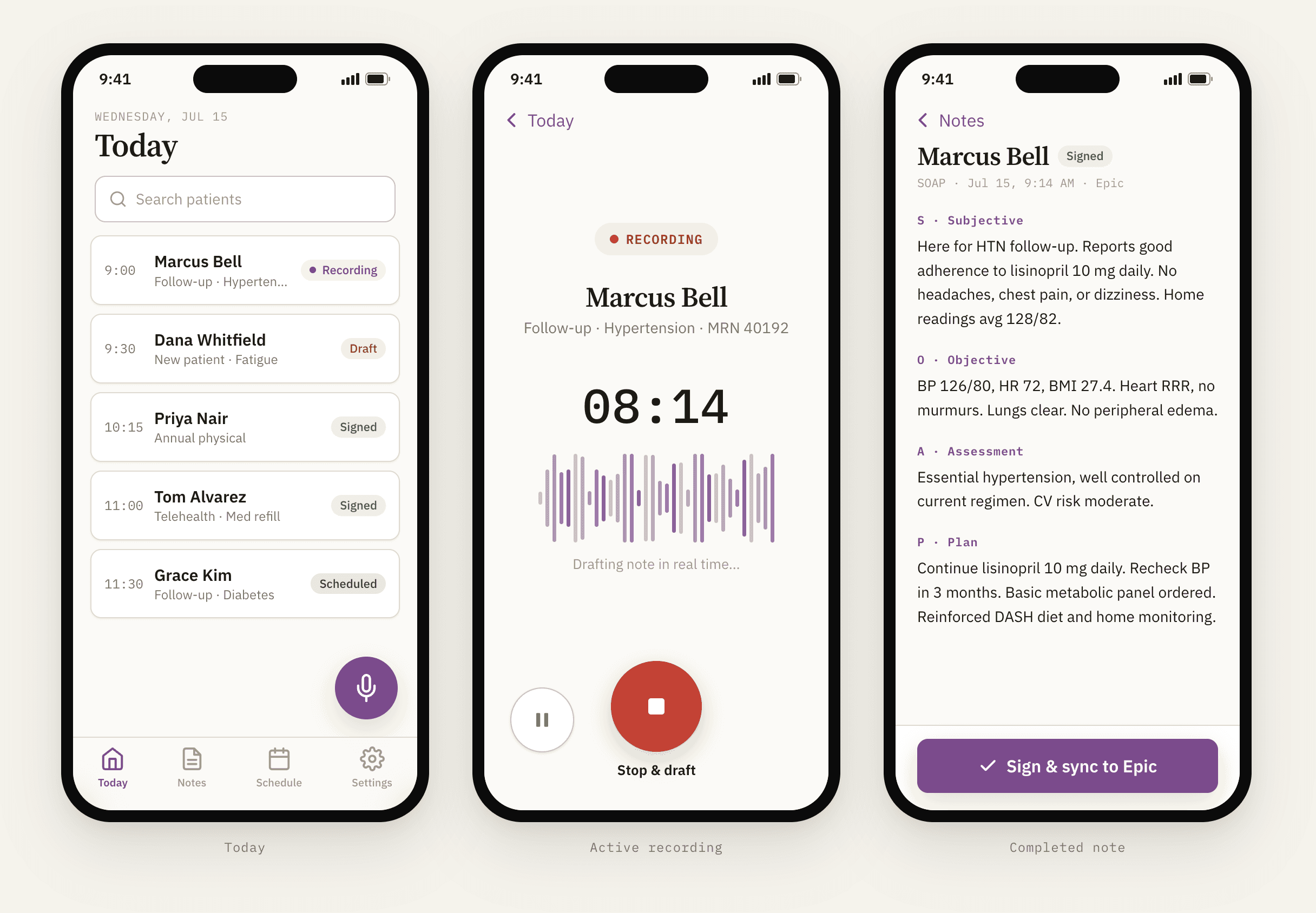 NoteV mobile app showing the Today schedule, active recording with waveform, and completed SOAP note screens