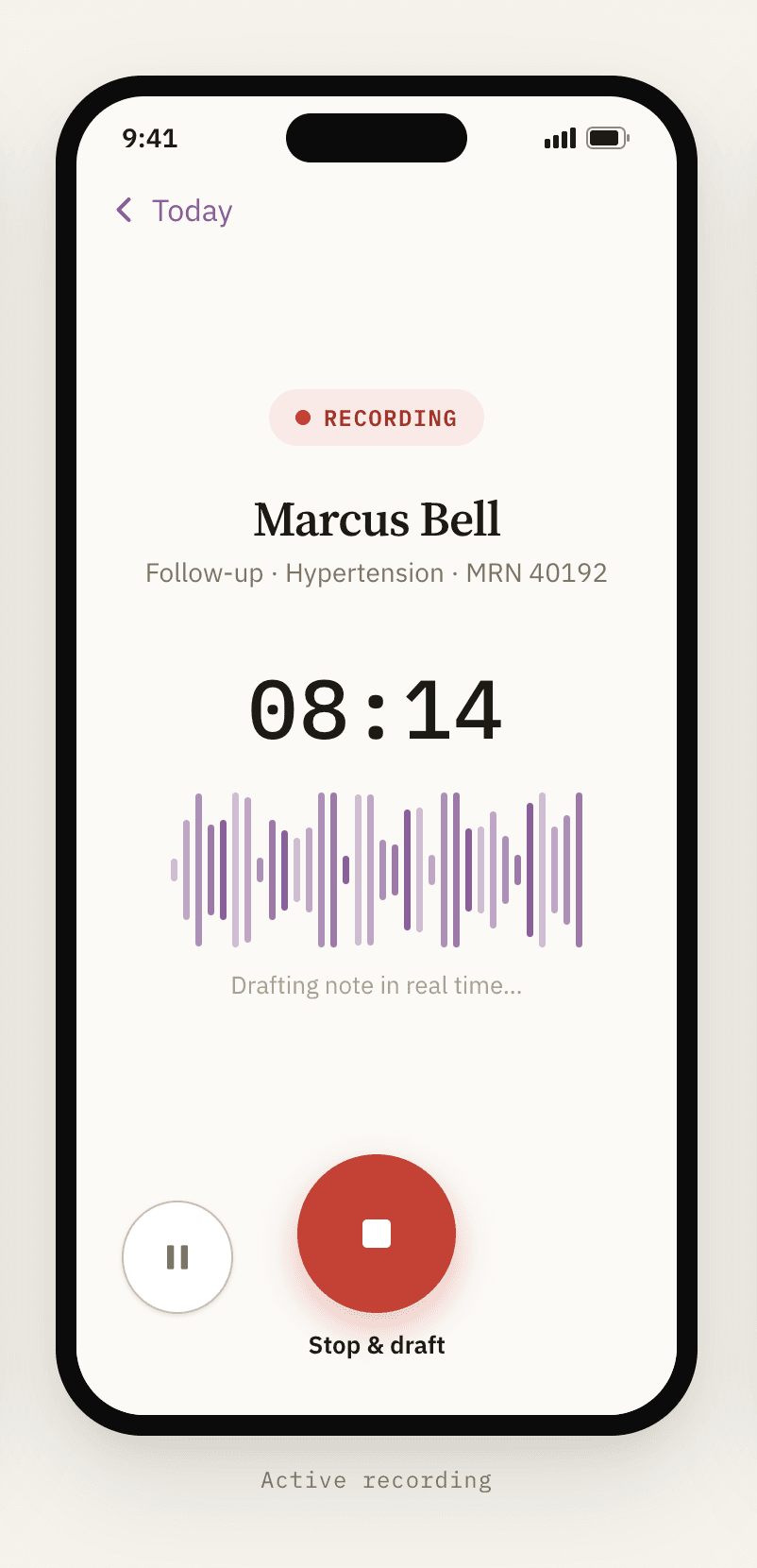 NoteV mobile app recording a patient encounter in real time